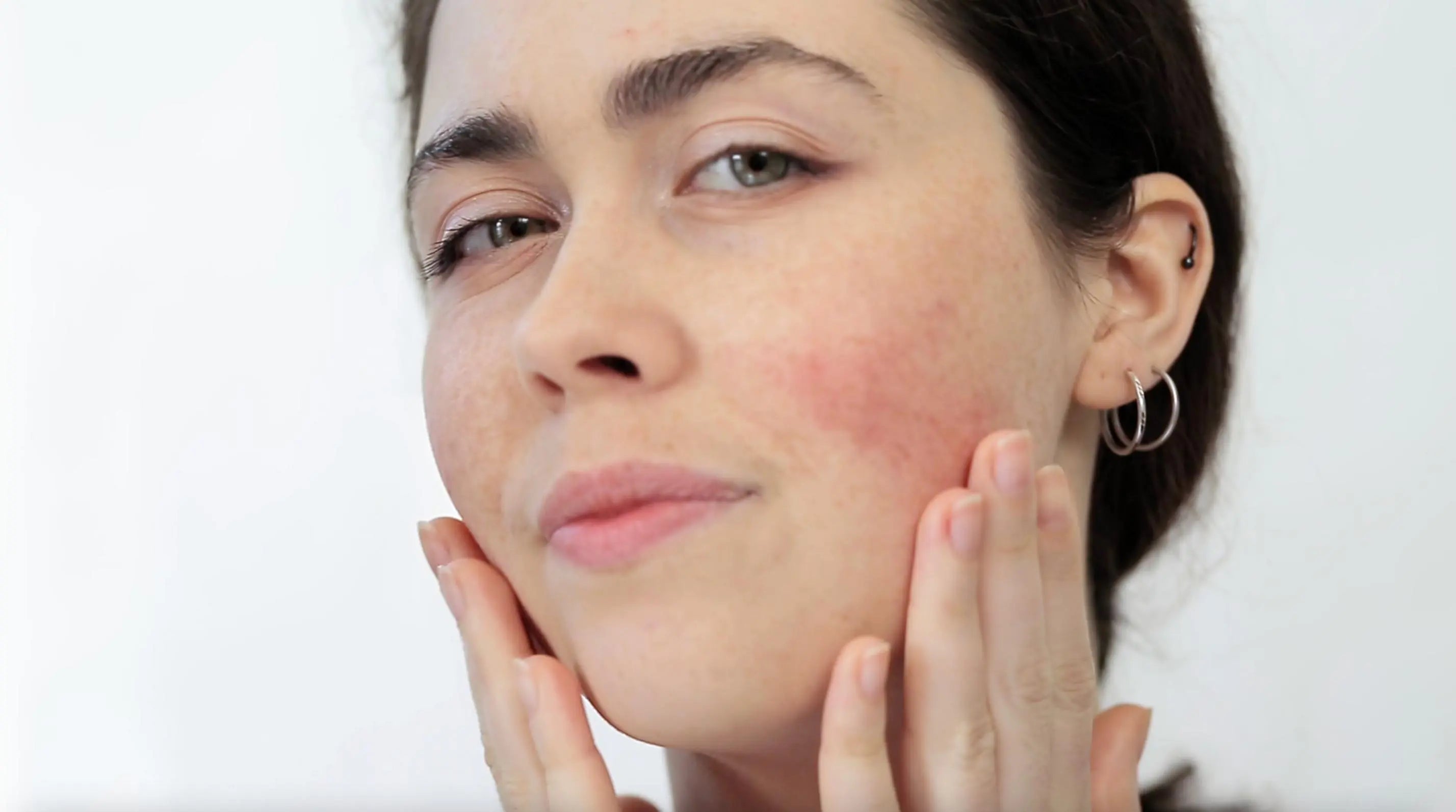 Suplementy na AZS – Jak zmniejszyć świąd i dolegliwości skóry atopowej