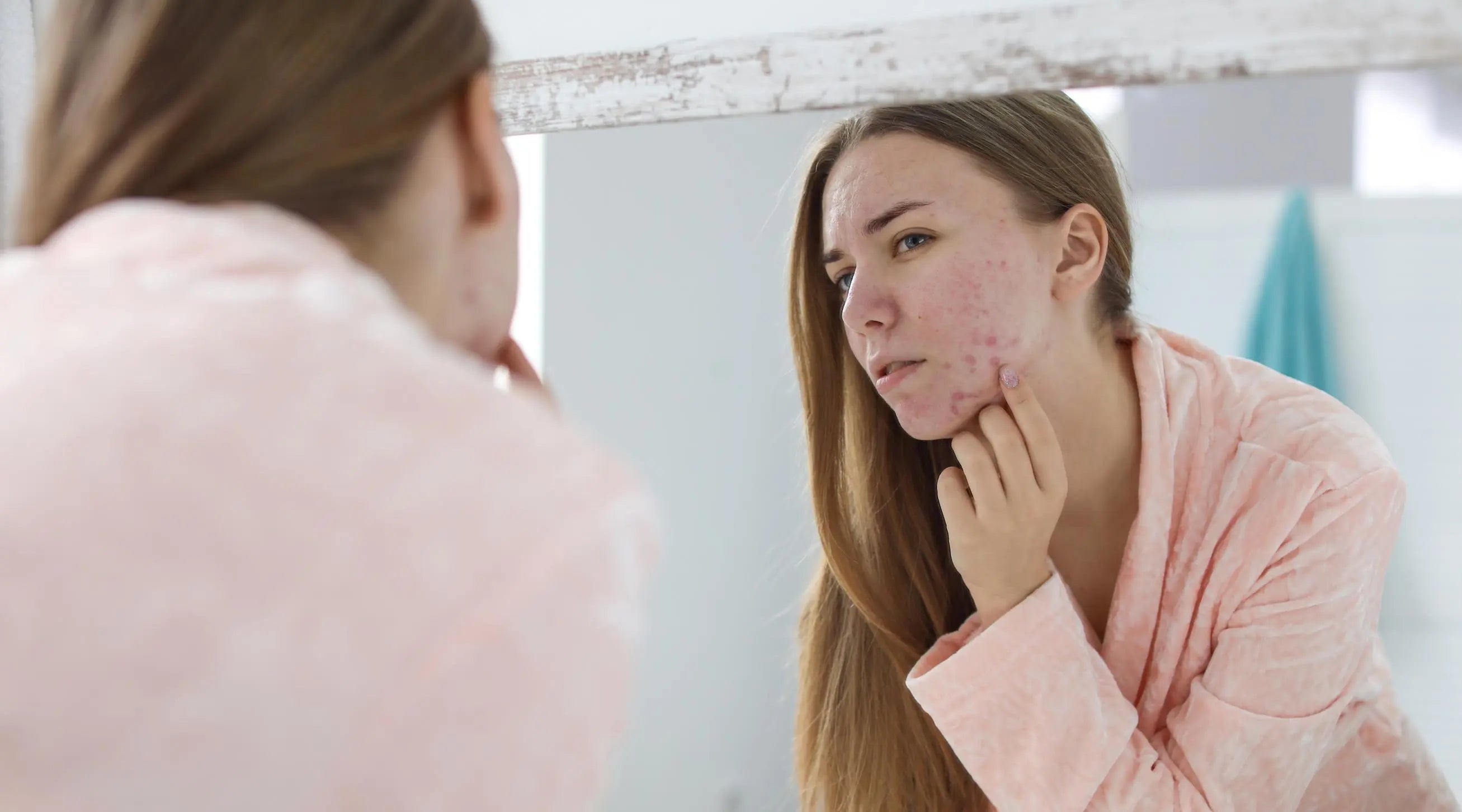 Suplementacja na PCOS, insulinooporność i trądzik