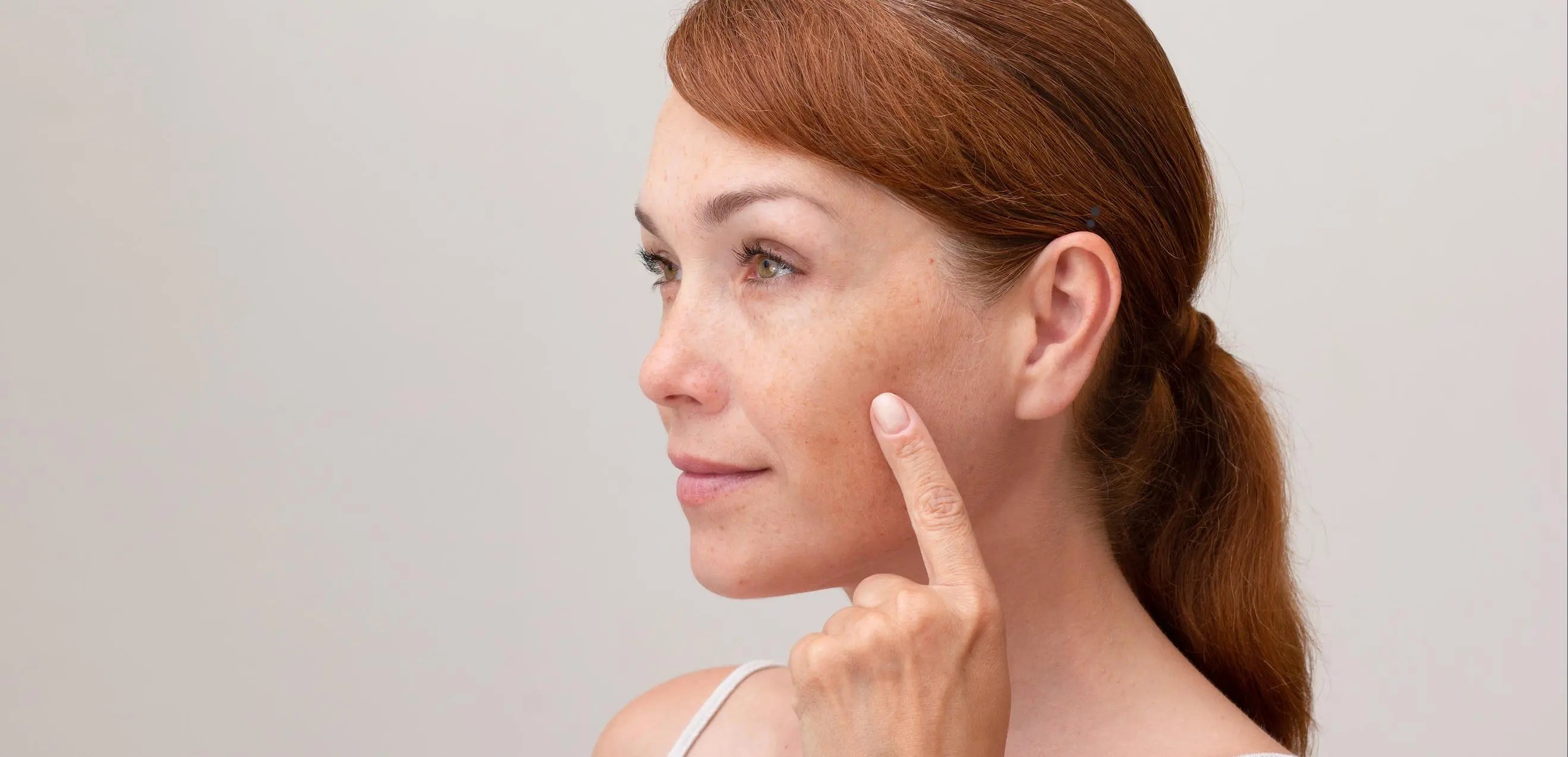 Jak pozbyć się przebarwień potrądzikowych - skuteczne metody