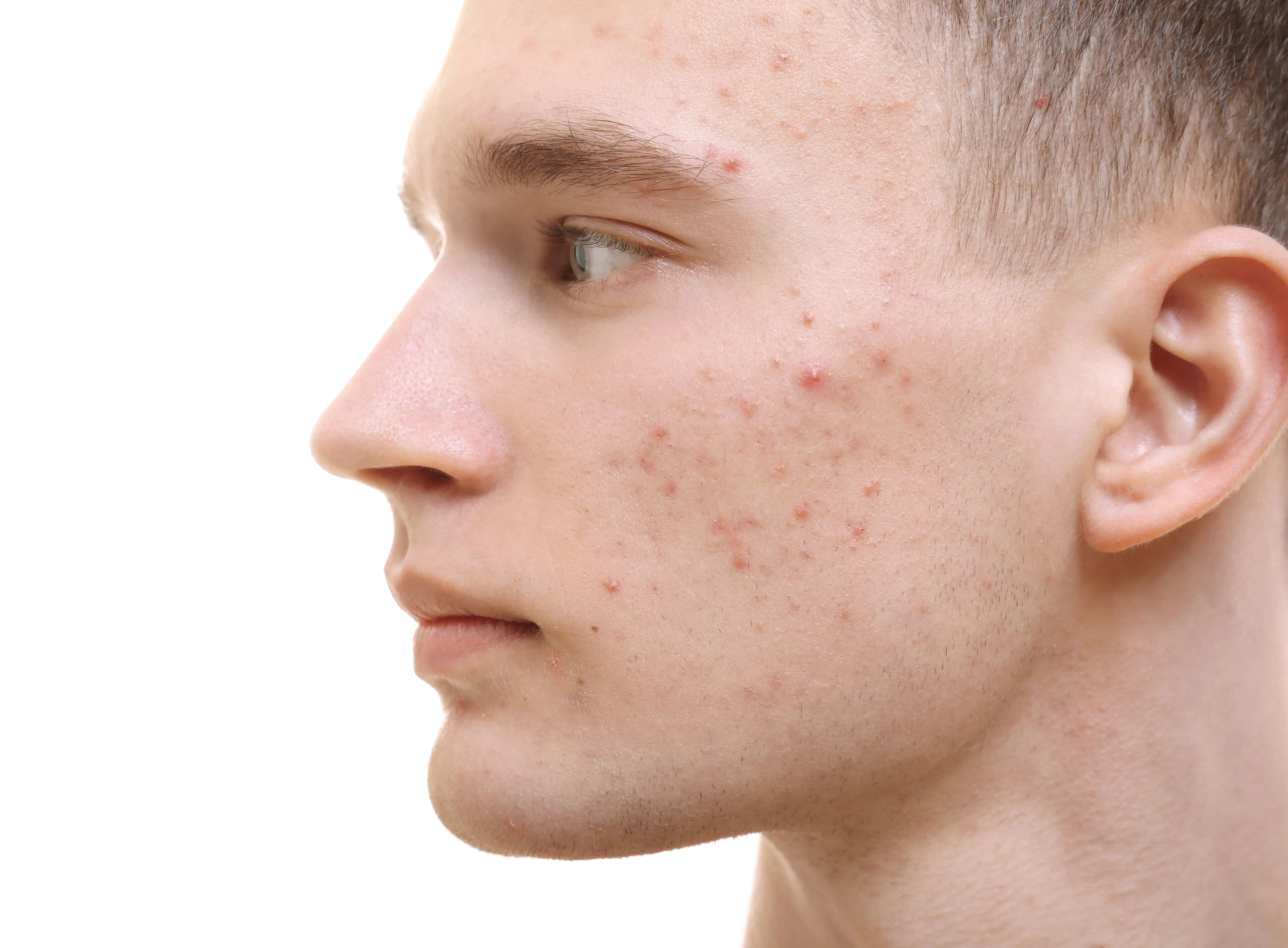 Raport „Psychodermatologia – jak stan skóry wpływa na zdrowie psychiczne Polaków”