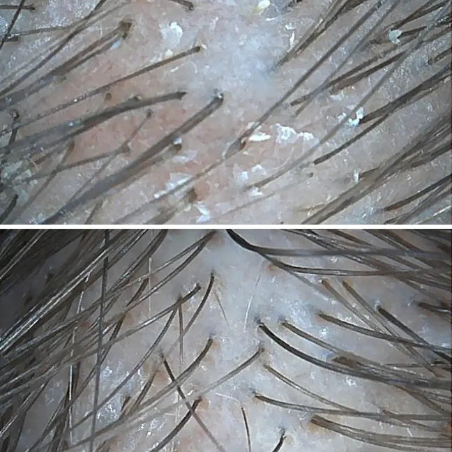Holistyczna terapia trychologiczna - case study