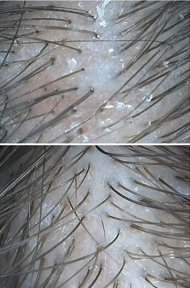 Holistyczna terapia trychologiczna - case study