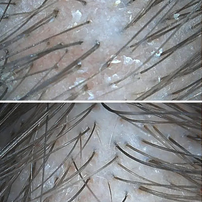 Holistyczna terapia trychologiczna - case study